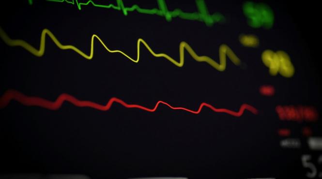 cardiolog alimente interzise sanatatea inimii