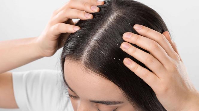 seleniu beneficii alege un sampon antimatreata eficient