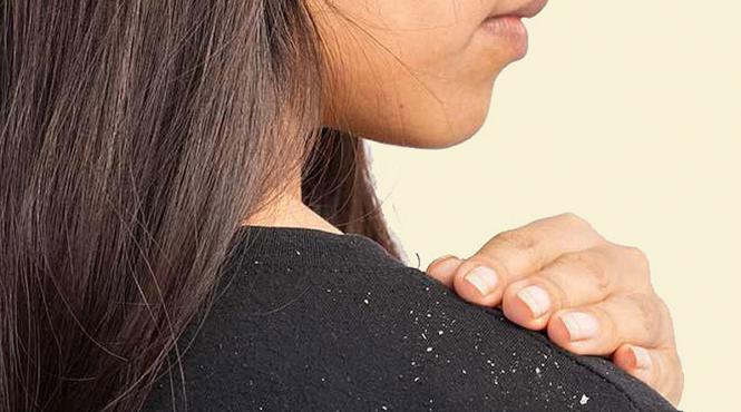 cum tratezi matreata ingrediente naturale ghid complet scalp sanatos