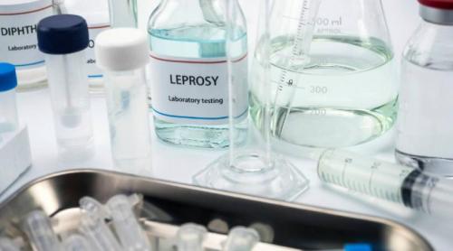 Un caz de lepră a fost confirmat la Cluj. Alte trei sunt sub evaluare, pacientele sunt maseuze din Asia