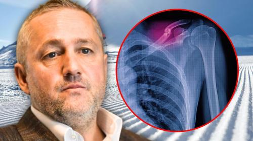 Cum se simte Mihai Rotaru după accidentul grav la schi: “Are 8 10 şuruburi în el!”. Exclusiv