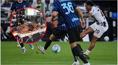 La ce tehnică tradițională chineză a apelat un fotbalist de la Juventus pentru recuperare. Imaginea cu care și a uimit fanii