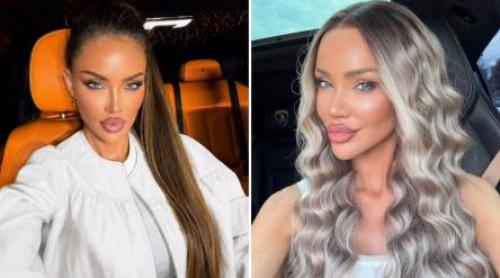 Cum arată Bianca Drăgușanu după ce și a operat urechile. Vedeta a arătat rezultatul după intervenția controversată