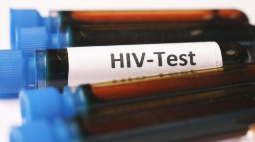 HIV în 2026: ce spun medicii despre speranța de viață
