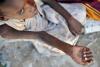 Imagini cutremurătoare din Somalia: 500.000 de copii în pragul morţii, din cauza foametei  (VIDEO) 910720