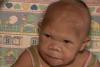 Caz medical incredibil: Are 30 de ani, dar seamănă cu un bebeluş! (VIDEO) 3135108