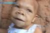 Caz medical incredibil: Are 30 de ani, dar seamănă cu un bebeluş! (VIDEO) 3135109