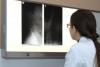 Medicii au încremenit când i-au văzut radiografia. Cazul lui a ajuns în revistele de specialitate 18460382