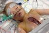 CAZ INCREDIBIL în Marea Britanie: Băieţel de 3 ani, operat pe inimă şi lăsat cu pieptul deschis, timp de 5 zile! (VIDEO) 18480608