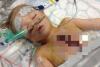 CAZ INCREDIBIL în Marea Britanie: Băieţel de 3 ani, operat pe inimă şi lăsat cu pieptul deschis, timp de 5 zile! (VIDEO) 18480609