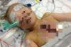 CAZ INCREDIBIL în Marea Britanie: Băieţel de 3 ani, operat pe inimă şi lăsat cu pieptul deschis, timp de 5 zile! (VIDEO) 18480614