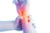 În artroze, grefarea unei proteze nu trebuie făcută prea târziu când articulaţia e deteriorată grav 18641427
