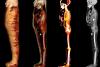 "Băiatul de aur" mumificat, un adolescent mort acum 2.300 de ani în Egipt, acoperit cu 49 de amulete prețioase 18822118