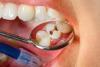 Inovație revoluționară: Japonia lucrează la un medicament pentru regenerarea dinților pierduți 18848113