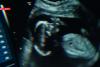 După ancheta exclusivă Observator, Bursa neagră a mamelor surogat, ministerul Sănătăţii trimite Corpul de Control în spitalele unde Observator a filmat cu camera ascunsă 19013371
